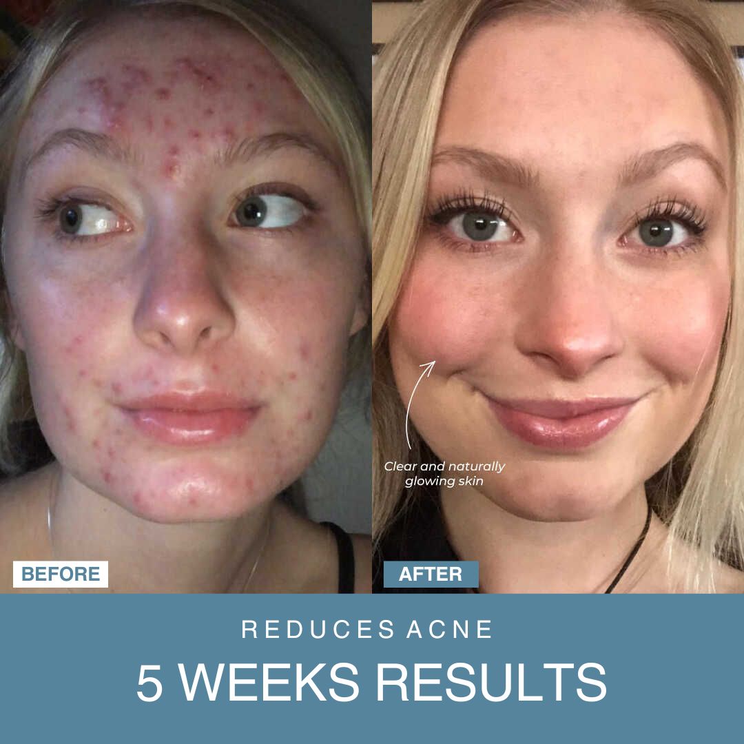 LED Facial Sculptor 7-in-1