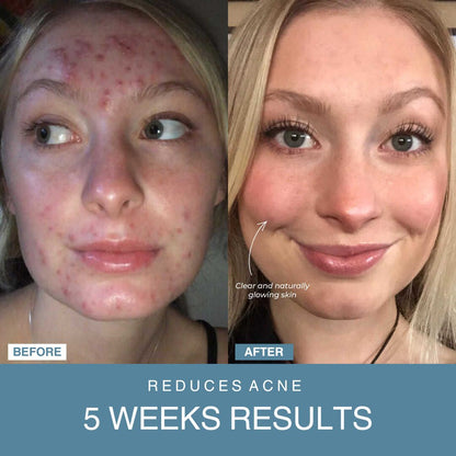 LED Facial Sculptor 7-in-1