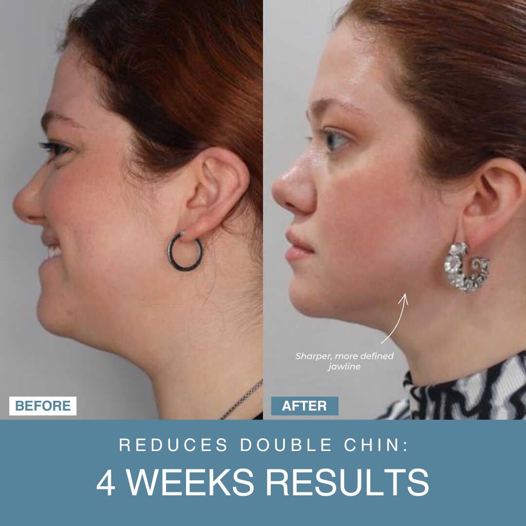 LED Facial Sculptor 7-in-1