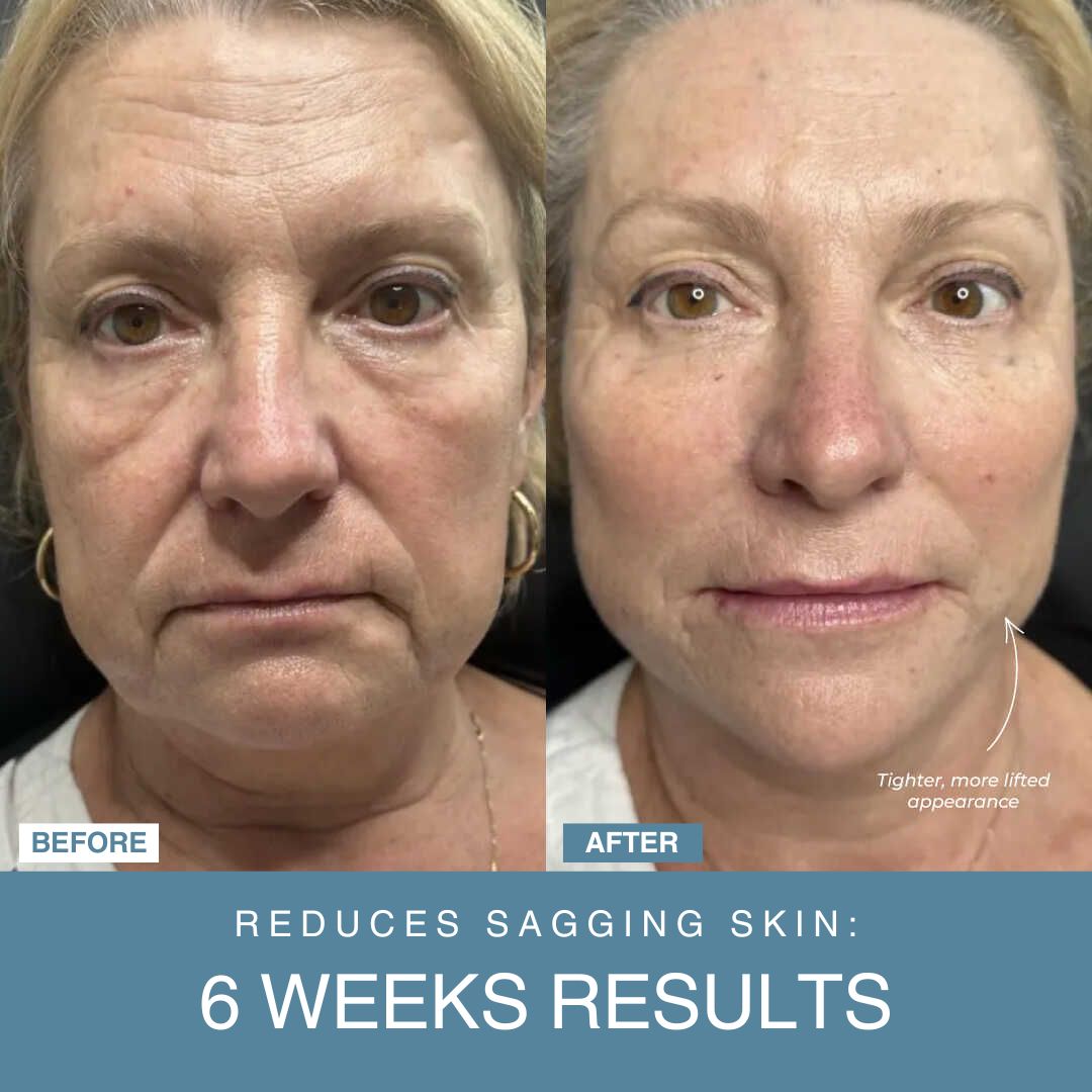 LED Facial Sculptor 7-in-1